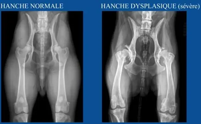 0-847-crbst_dysplasie_hanches.jpg.webp