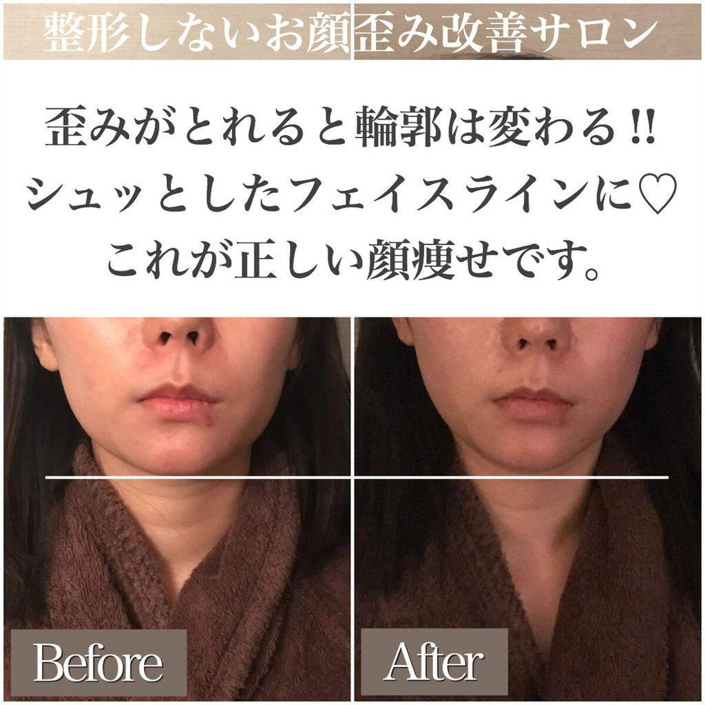 歪みがとれると輪郭は変わる 正しく顔痩せして小顔美人に