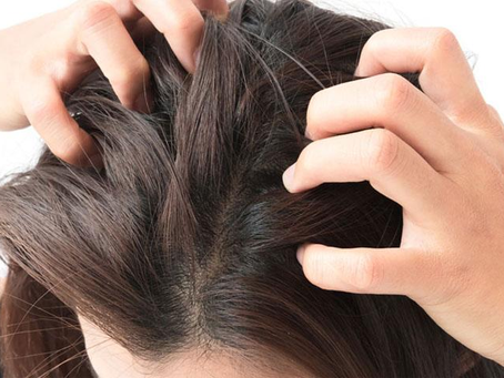 Hjelp jeg har sensitiv hodebunn!