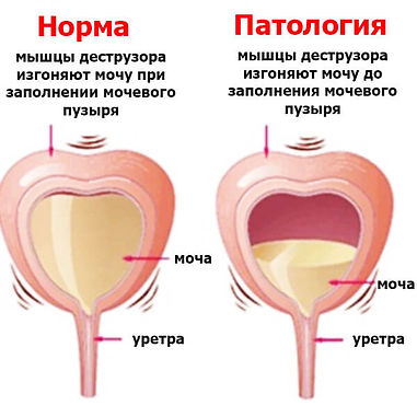 НДМП3.jpeg