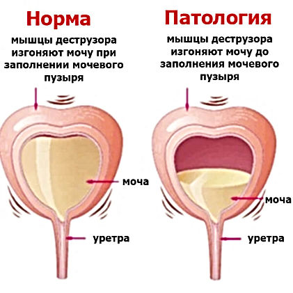 НДМП3.jpeg