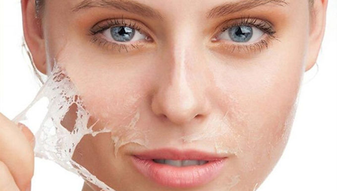 CHEMICAL SKIN PEELS