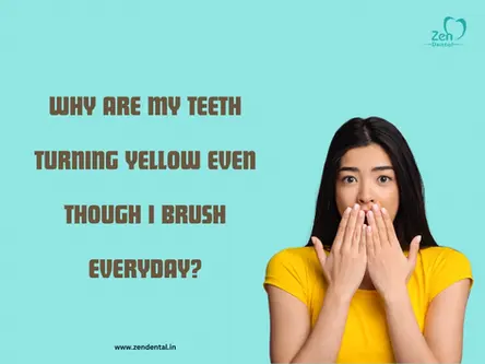 WHY ARE MY TEETH TURNING YELLOW EVEN THOUGH I BRUSH EVERY DAY?