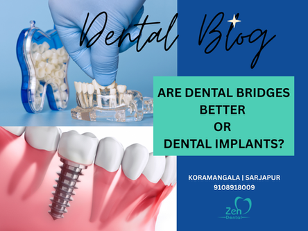 ARE DENTAL BRIDGES BETTER OR DENTAL IMPLANTS?