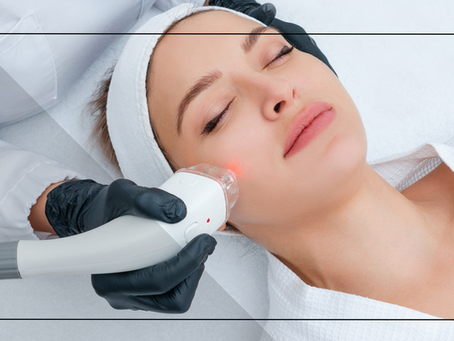Transform your skin - The benefits of microneedling