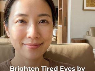Brighten Tired Eyes by Filling Under-Eye Hollows with Dermal Fillers!