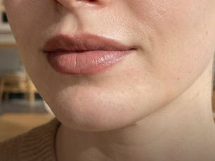 Smooth and Youthful: Reduce Lip Lines for Radiant Lips