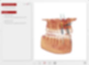 planejamento implantes dentários com NobelClinician