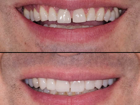 Você quer fazer um "Test Drive" do sorriso?