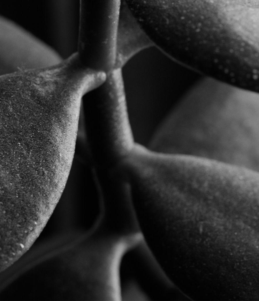 Thumbnail: Jade Crassula Ovata, Pigment Prints 2017 Miguel Winograd photography black and white, still life, nature landscape