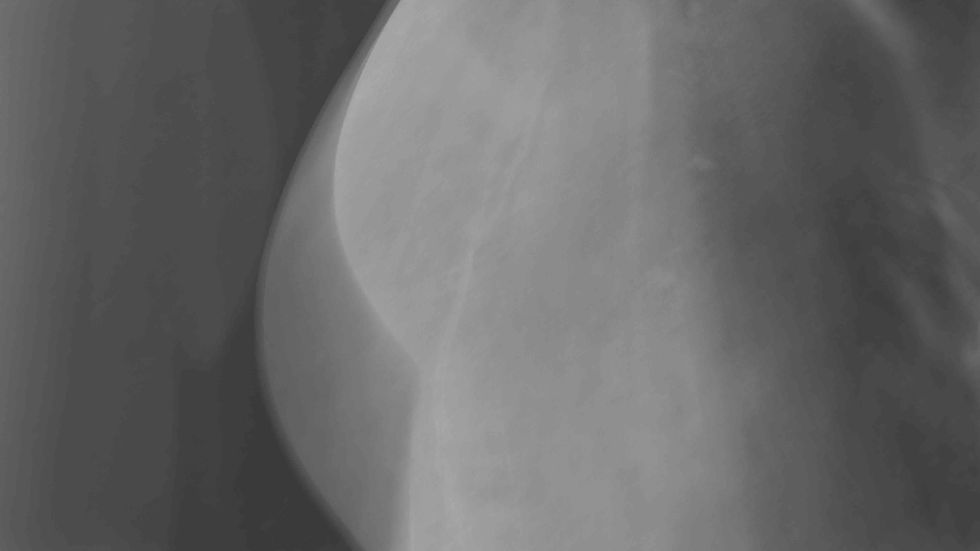 Thumbnail: ROMA 2012 B 01bn and Roma 2021 M Vaticani 41invbn, 2014  From Touching the skin of the past  Archival Pigment Print