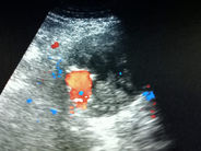 CORSI DI ECO-COLOR-DOPPLER VASCOLARE PER DIAGNOSTICA DI I LIVELLO TENUTI DAL DOTT. R.GIBELLINI*