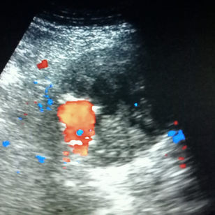 CORSI DI ECO-COLOR-DOPPLER VASCOLARE PER DIAGNOSTICA DI I LIVELLO TENUTI DAL DOTT. R.GIBELLINI*