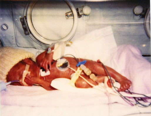 CPBF Unicorn Files : Victoria’s Brighter World; A unicorn in a world full of horses