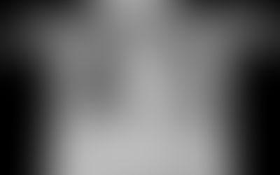 Bronchopulmonary Dysplasia and Chronic Lung Disease