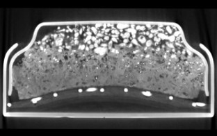CT scan cross section of a butto battery showing details of anode and cathode