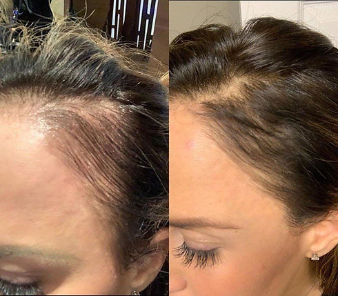 Keravive+before+and+after-1920w.jpg