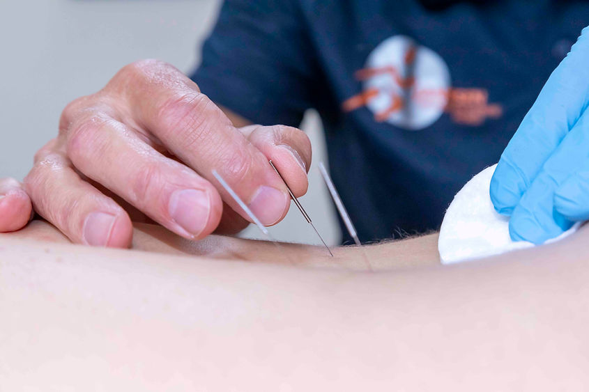 Dry needling Cor Janssen