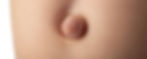 Paciente con hernia umbilical evaluado por cirujano en Guayaquil, Ecuador
