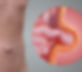 hernia-umbilical-1280x720_edited.jpg