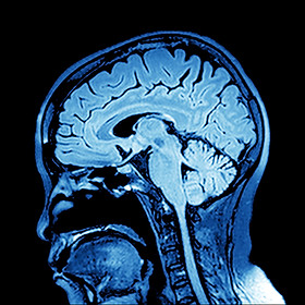 Imaging of the brain on x-ray .jpg