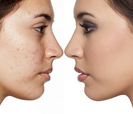 gommage_exfoliation-1.jpg