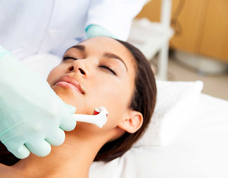 Microneedling.jpg