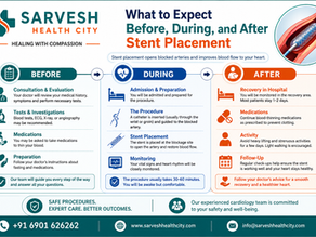 What to Expect Before, During, and After Stent Placement