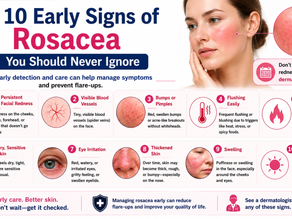 Top 10 Early Signs of Rosacea You Should Never Ignore