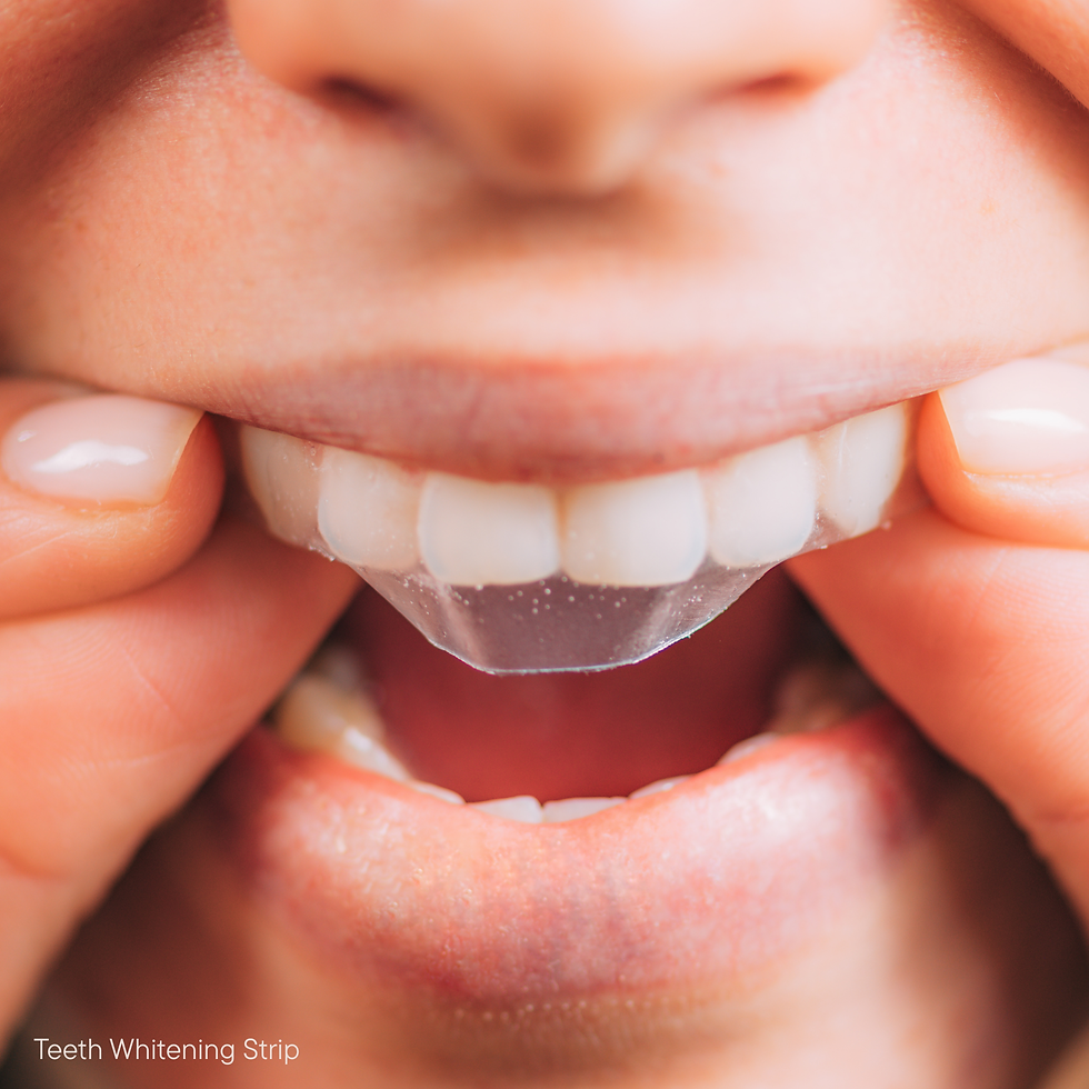 Teeth Whitening Strips vs Professional Teeth Whitening: What Actually Works Best?