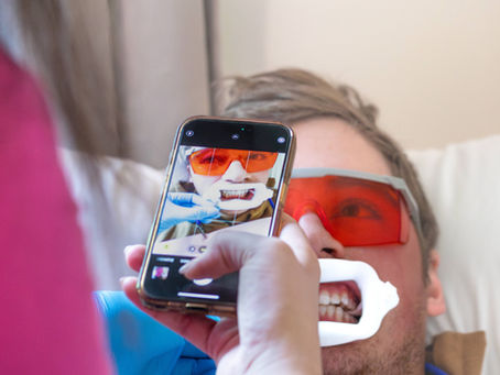 Teeth Whitening Myths That Need to Retire This Year