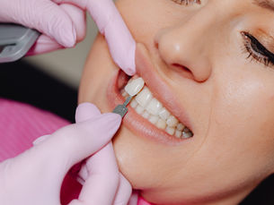 Professional Teeth Whitening