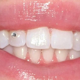 Tooth Gem Aftercare: How to Make Your Sparkle Last