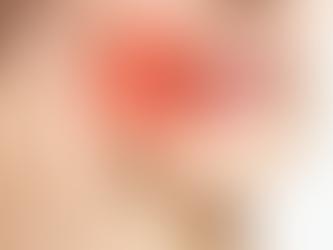 Stop the Sting: Simple Ways to Manage Sensitive Teeth