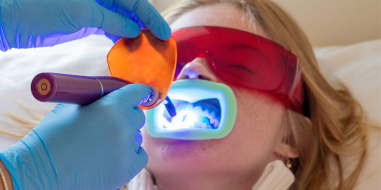 Professional Teeth Whitening