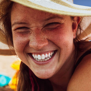 Why Professional Teeth Whitening Belongs on Your Summer To-Do List