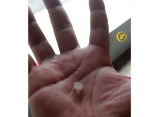Chuva de granizo atinge alguns bairros de Cachoeira do Sul