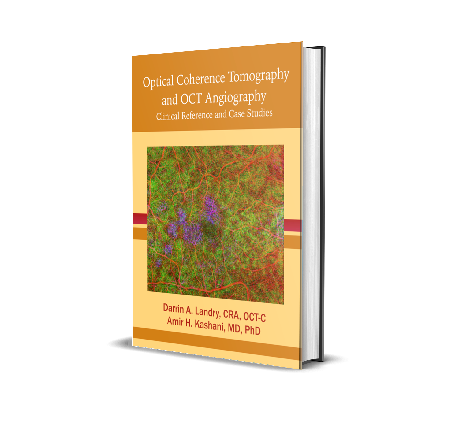 Optical Coherence Tomography and OCT Angiography: Clinical Reference and Case St