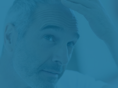 DESCUBRA O QUE CAUSA A QUEDA DE CABELO MASCULINO!