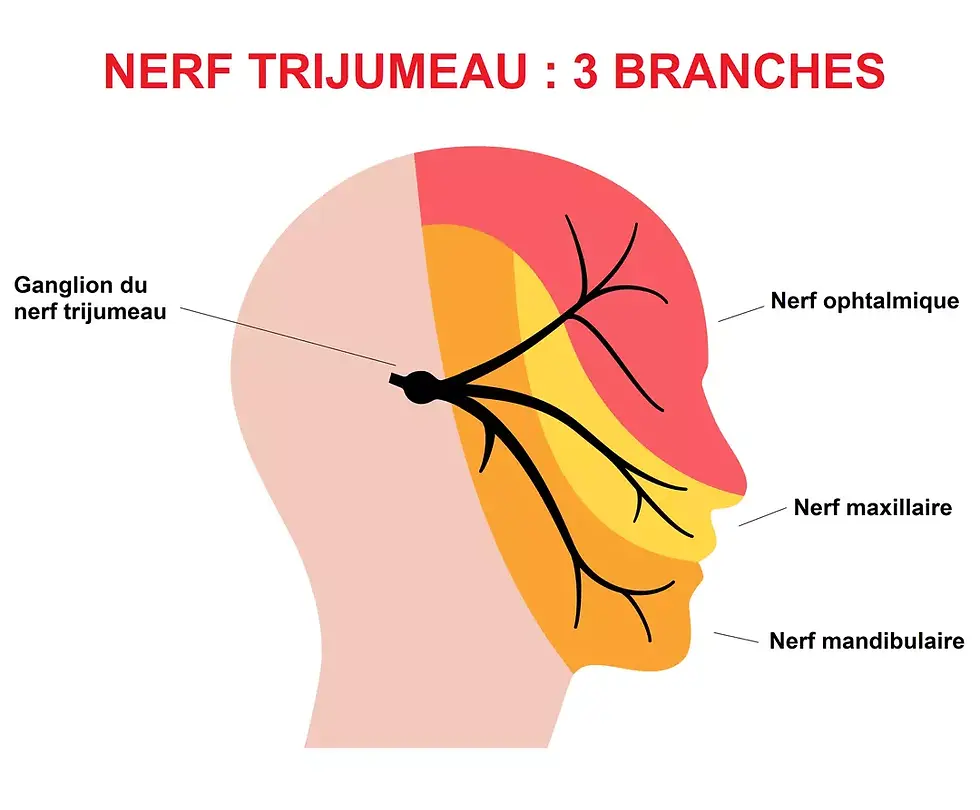 soulager migraines