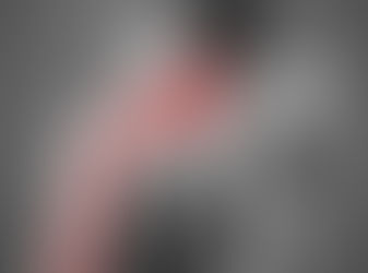 Nevralgie cervico-brachiale