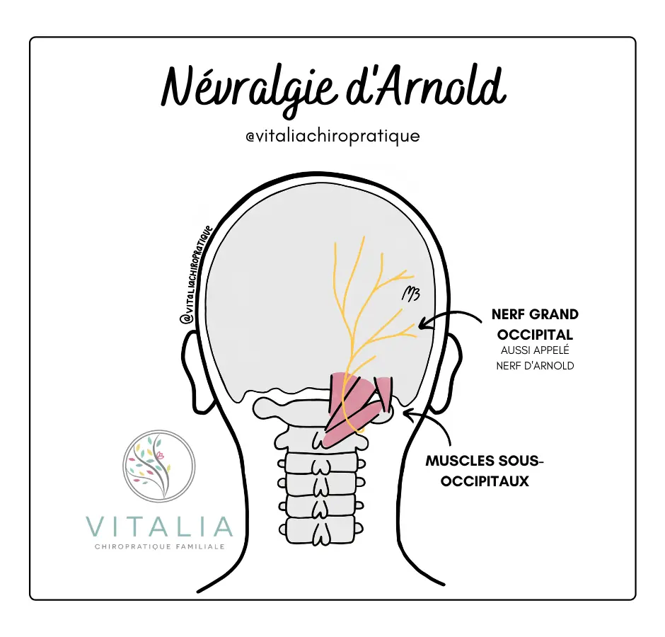 soulager migraines