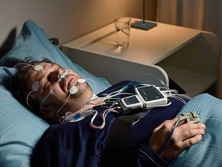Sleep Study Explained: What Happens During a Split Night Sleep Study?