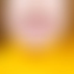 STUDY FINDS MALOCCLUSIONS CONNECTED TO ADHD