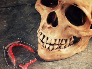 ORIGINS OF MALOCCLUSION AND AIRWAY DISORDERS
