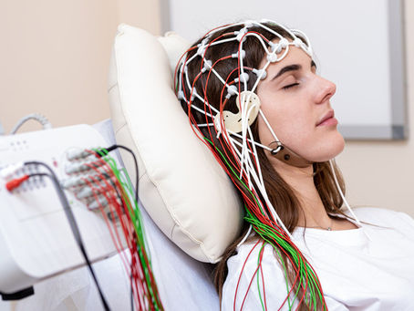 What Is an EEG? Seizure Testing in Austin & Houston