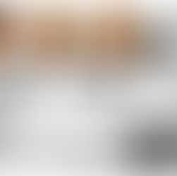 UNDERSTANDING  CONDYLAR RESORPTION