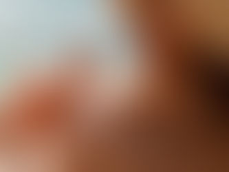 Sociedade Brasileira de Dermatologia intensifica a luta contra o câncer de pele