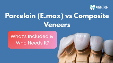 Porcelain (E.max) vs Composite Veneers – Cost & Durability in Bangalore
