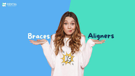 Braces Vs Aligners - Which one to choose?
